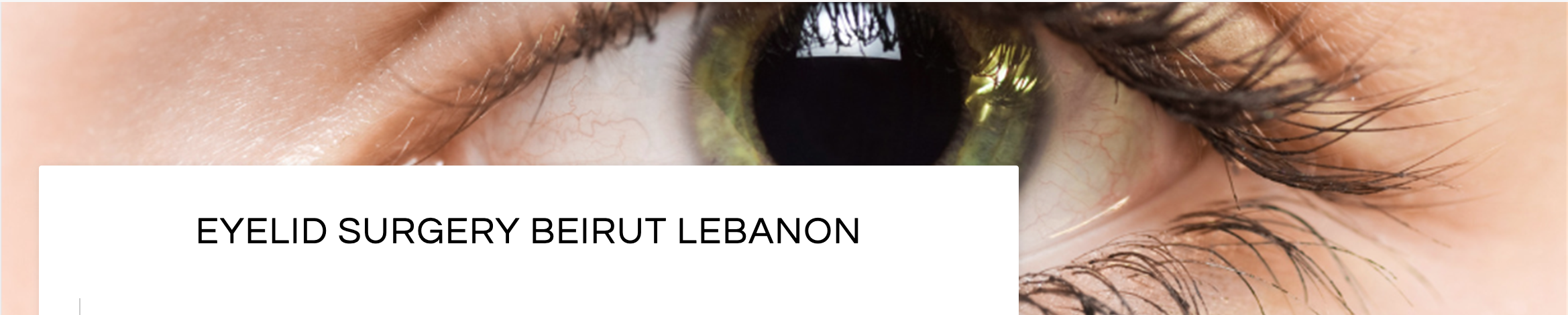 Best eyelid surgery for saudi tourists in beirut lebanon