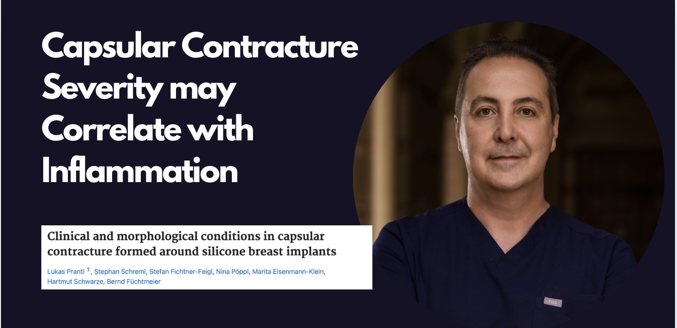 Dr. Raffy Karamanoukian in Beirut lebanon